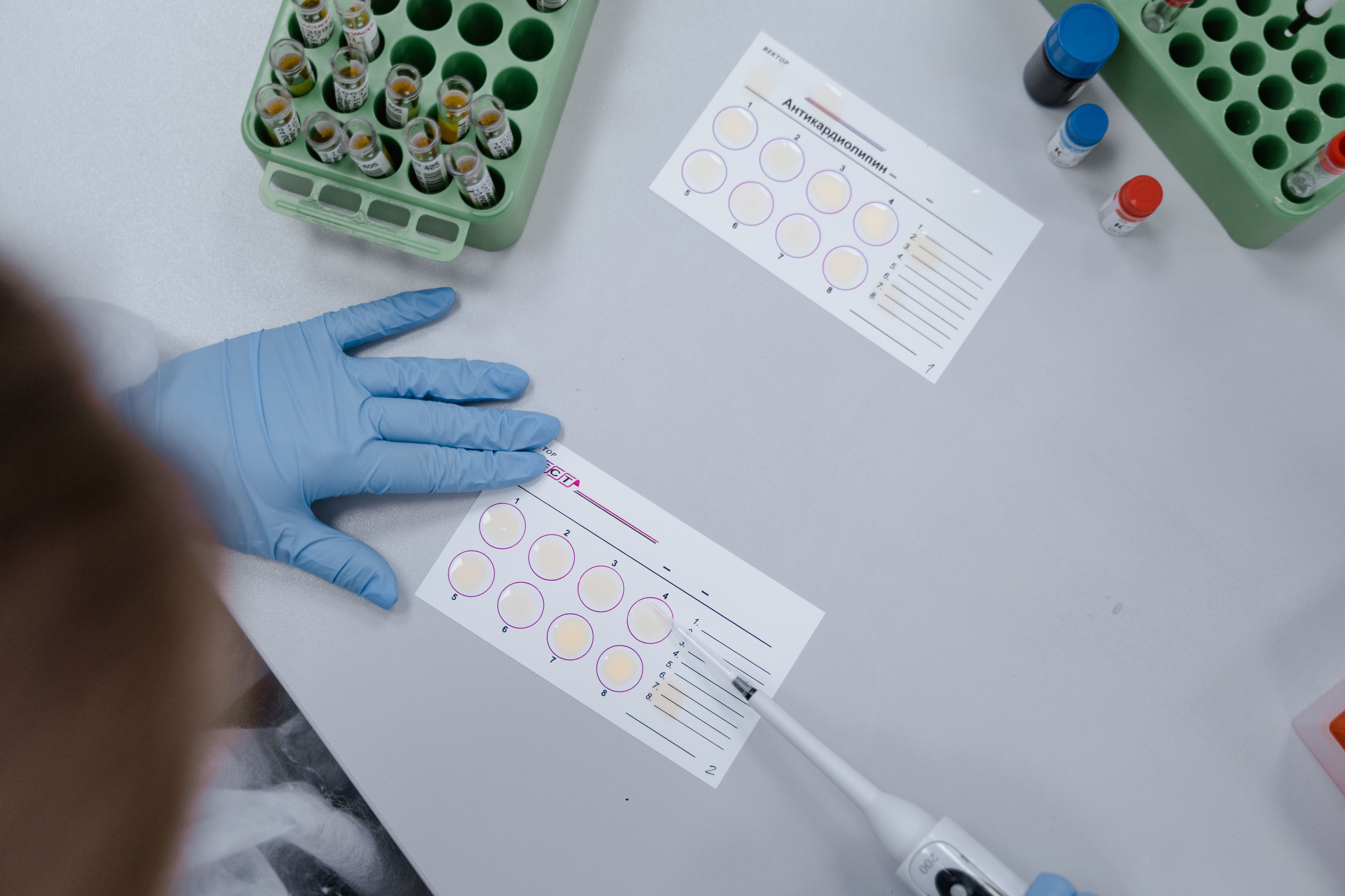 Gut Microbiome Test